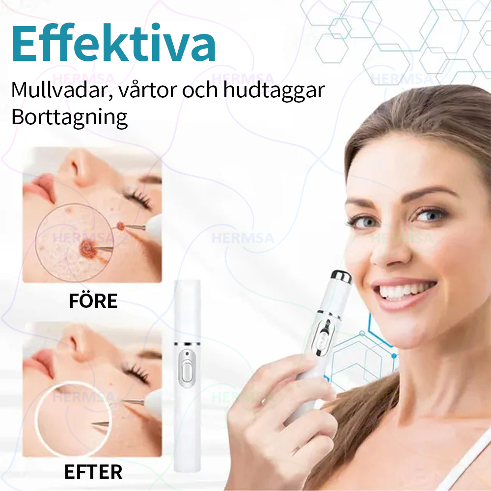 Hermsa® noninvasiivinen laserosoitin - luomen ja syylän poisto (🔥Viimeinen päivä 80% alennus)