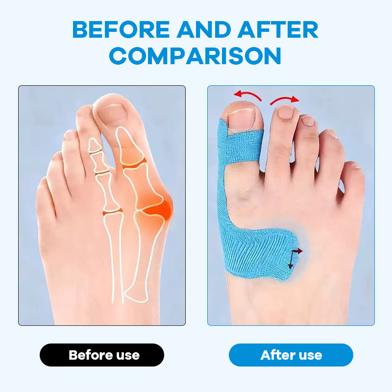 Onzichtbare Hallux Valgus Tape: Pijnvrij lopen in elke schoen! 🦶✨