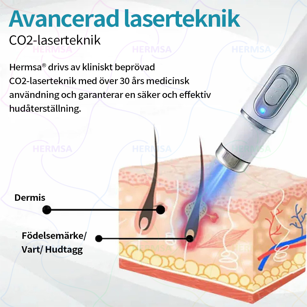 Hermsa® noninvasiivinen laserosoitin - luomen ja syylän poisto (🔥Viimeinen päivä 80% alennus)