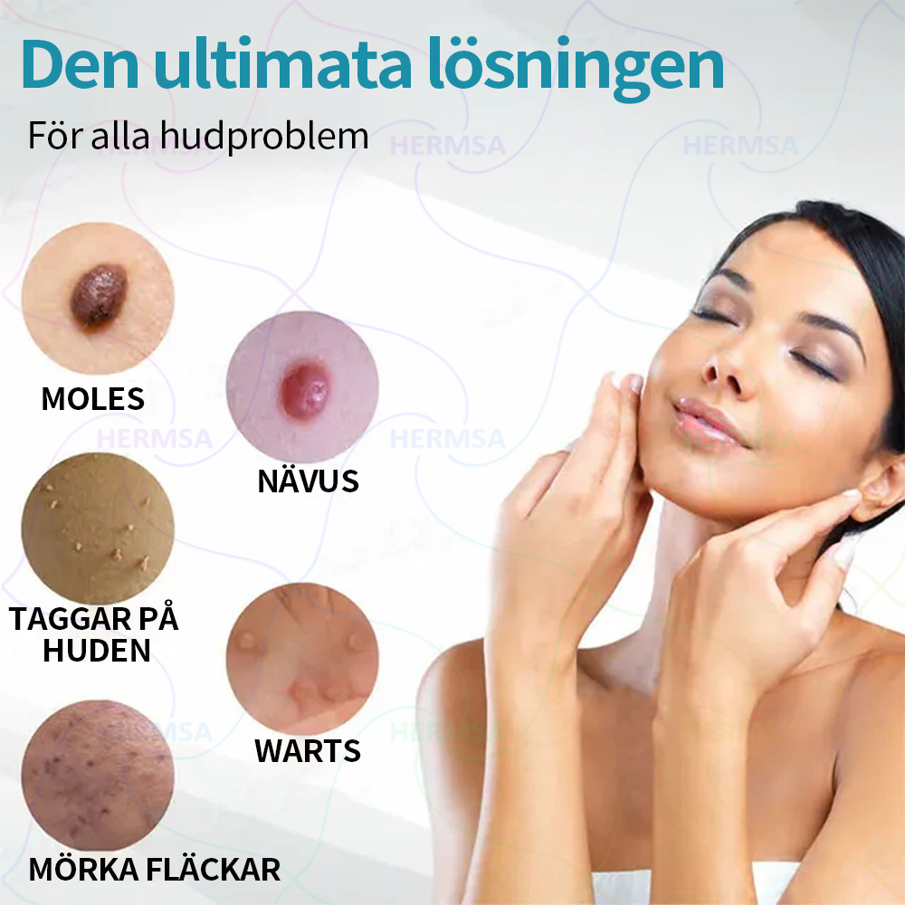 Hermsa® noninvasiivinen laserosoitin - luomen ja syylän poisto (🔥Viimeinen päivä 80% alennus)